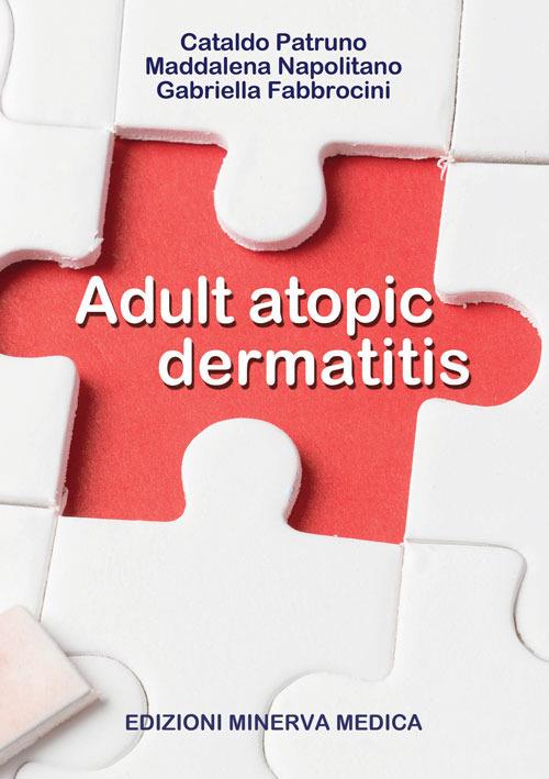 Adult atopic dermatitis - Cataldo Patruno,Maddalena Napolitano,Gabriella Fabbrocini - copertina