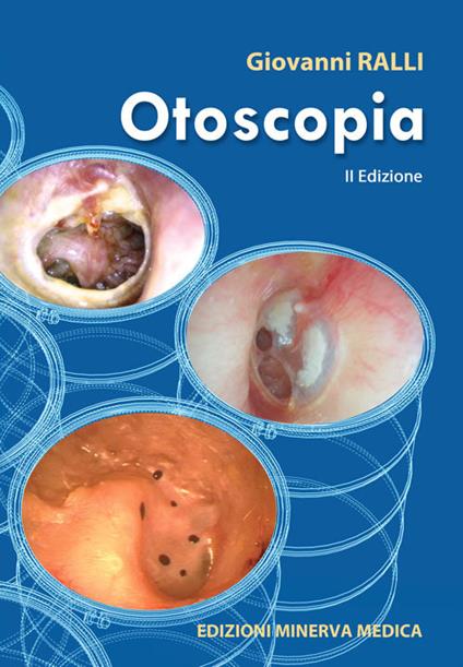 Otoscopia - Giovanni Ralli - copertina