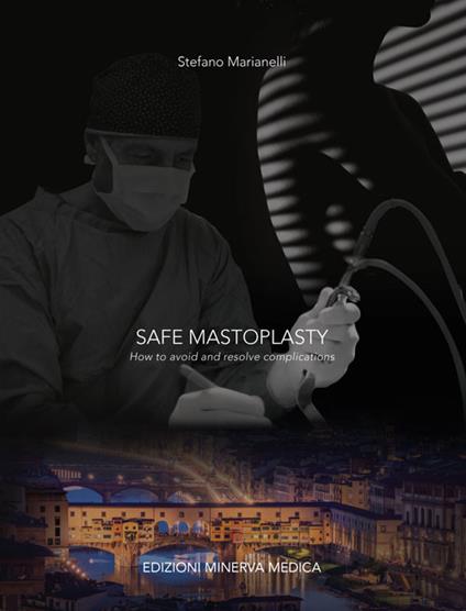 Safe mastoplasty. How to avoid and resolve complications - Stefano Marianelli - copertina
