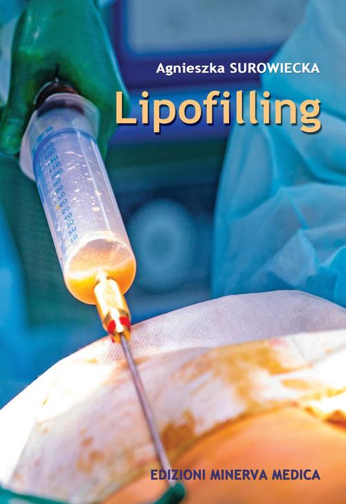 Lipofilling - Agnieszka Surowiecka - copertina