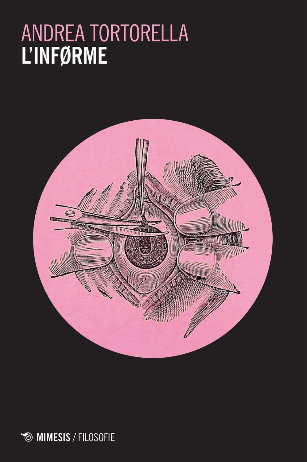 ibs