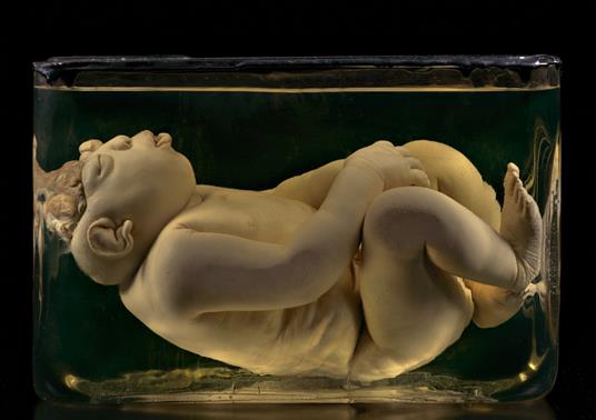 Sua maestà anatomica. Museo Morgagni di Padova. Ediz. italiana e inglese - Ivan Cenzi,Carlo Vannini - 5