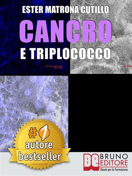 Cancro e triplococco - Ester Matrona Cutillo - ebook