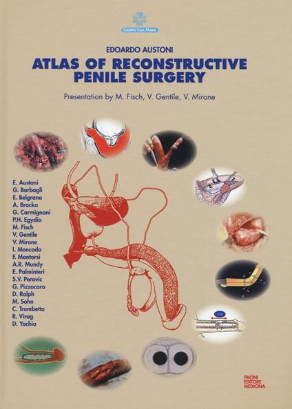 Atlas of reconstructive penile surgery. Ediz. illustrata - copertina