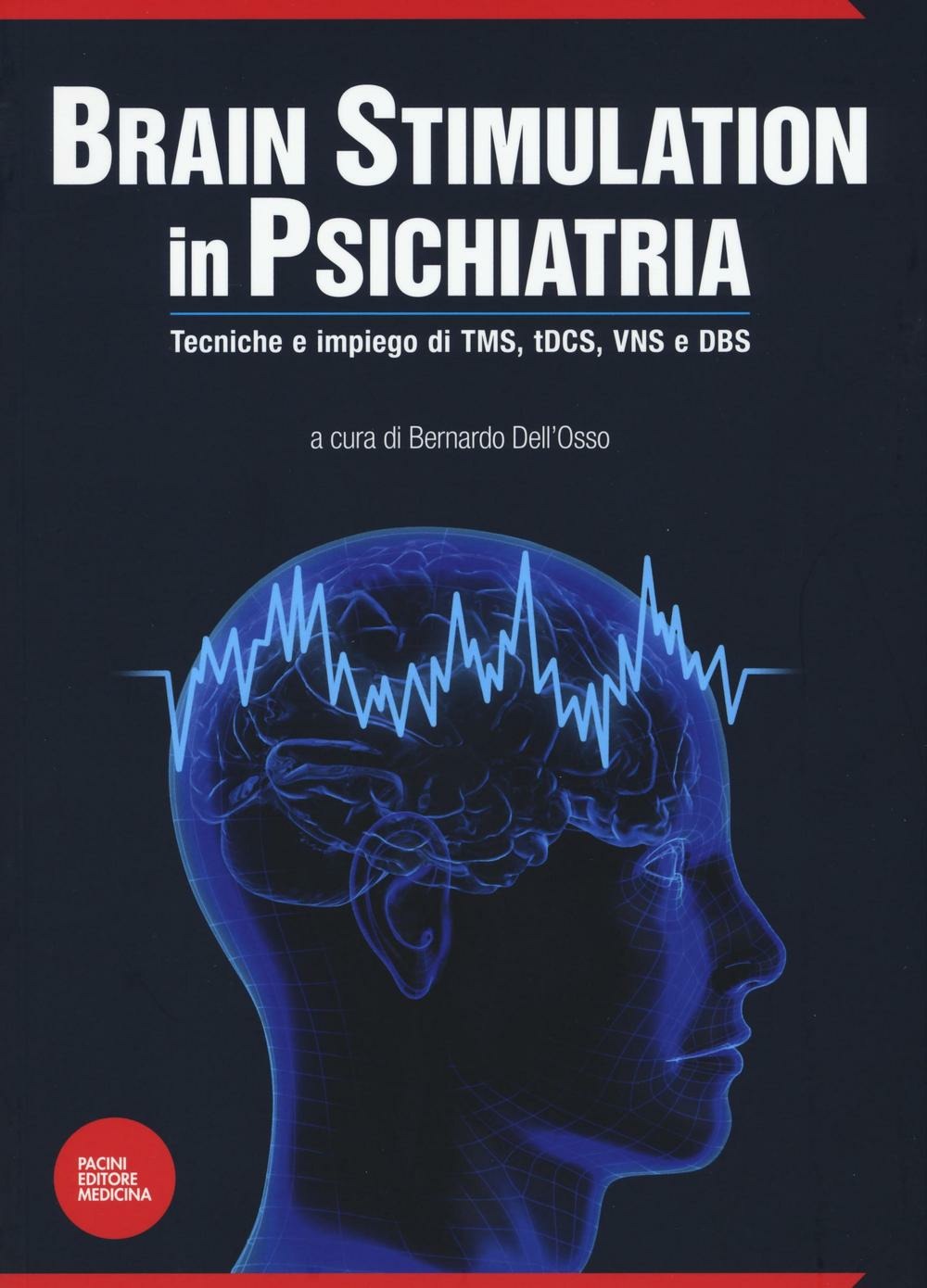 ibs