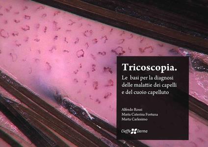 Tricoscopia. Le basi per la diagnosi delle malattie dei capelli e del cuoio capelluto. Nuova ediz. - Alfredo Rossi,Marta Carlesimo,Maria Caterina Fortuna - copertina