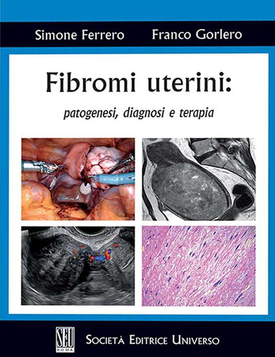 Fibromi uterini: patogenesi, diagnosi e terapia - Simone Ferrero,Franco Gorlero - copertina
