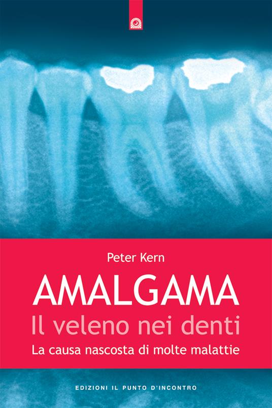 Amalgama. Il veleno nei denti. La causa nascosta di molte malattie - Peter Kern,S. Camatta - ebook
