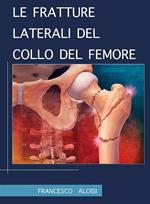 Le fratture laterali del collo del femore