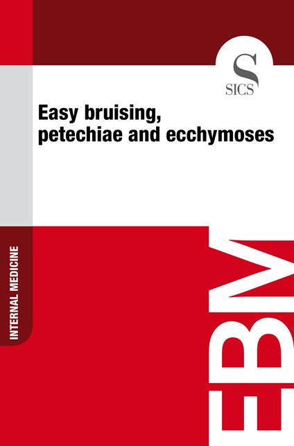 Easy Bruising, Petechiae and Ecchymoses