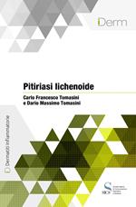 Pitiriasi lichenoide