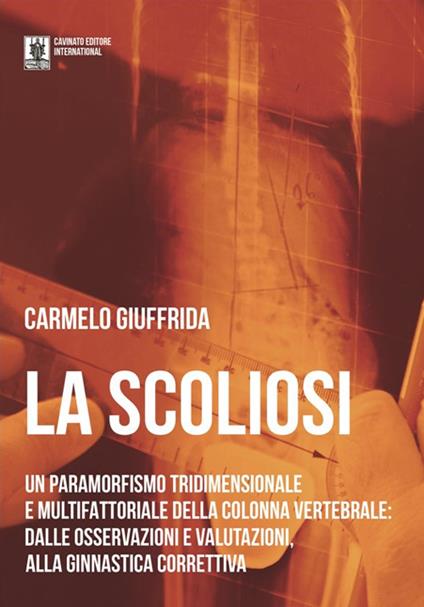La scoliosi. Un paramorfismo tridimensionale e multifattoriale della colonna vertebrale: dalle osservazioni e valutazioni alla ginnastica correttiva - Carmelo Giuffrida - copertina