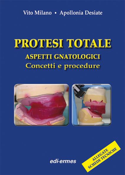 Protesi totale. Aspetti gnatologici. Concetti e procedure - Vito Milano,Apollonia Desiate - copertina