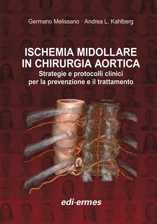 Ischemia midollare in chirurgia aortica. Strategie e protocolli clinici per la prevenzione e il trattamento - copertina