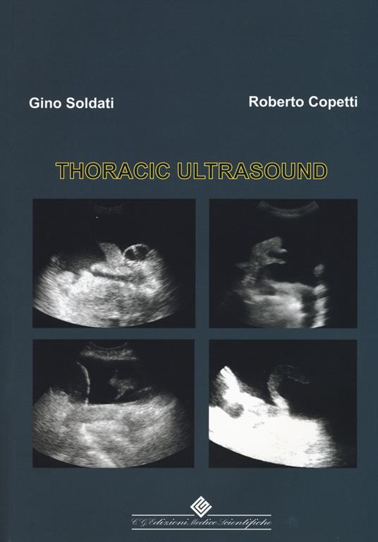 Thoracic ultrasound - Gino Soldati,Roberto Copetti - copertina