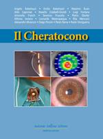 Il cheratocono