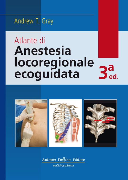 Atlante di anestesia locoregionale ecoguidata. Con Contenuto digitale per download e accesso online - Andrew T. Gray - copertina
