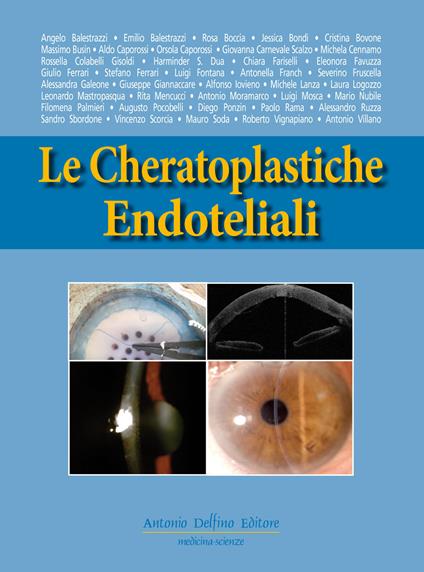 Le cheratoplastiche endoteliali - copertina
