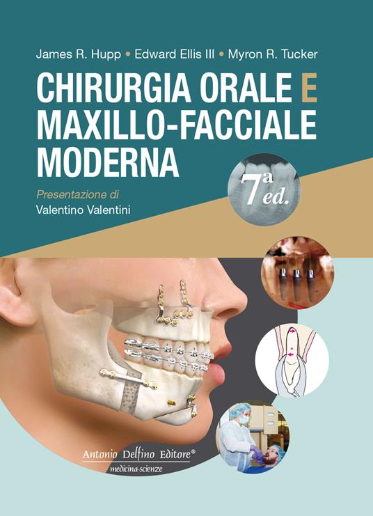 Chirurgia orale e maxillo-facciale moderna - J.R. Hupp,III E. Ellis,M.R. Tucker - copertina