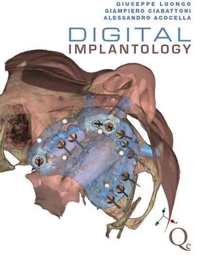 Digital implantology. Ediz. inglese - Giuseppe Luongo,Giampiero Ciabattoni,Alessandro Acocella - copertina