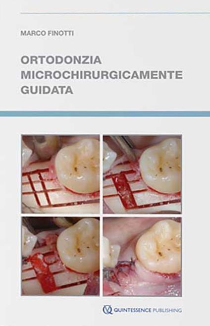 Ortodonzia microchirurgicamente guidata - Marco Finotti - copertina