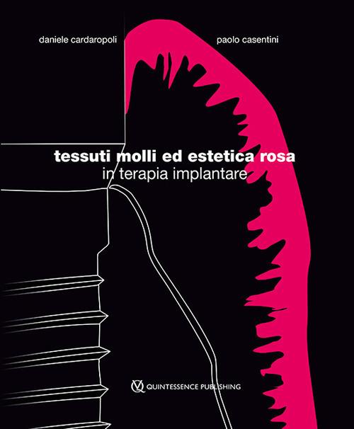 Tessuti molli ed estetica rosa in terapia implantare - Daniele Cardaropoli,Paolo Casentini - copertina