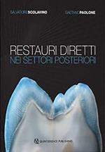 Restauri diretti nei settori posteriori