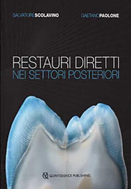 Restauri diretti nei settori posteriori - Salvatore Scolavino,Gaetano Paolone - copertina