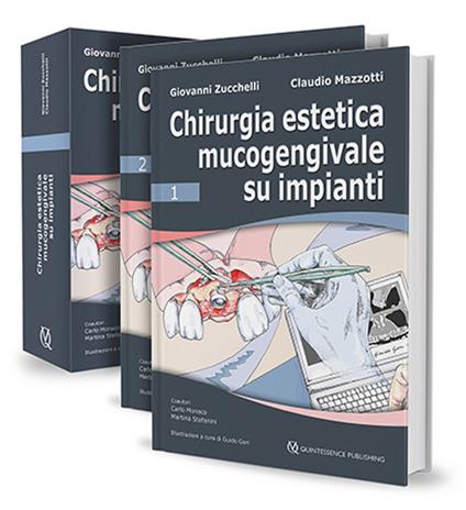 Chirurgia estetica mucogengivale su impianti - Giovanni Zucchelli,Claudio Mazzotti,Carlo Monaco - copertina