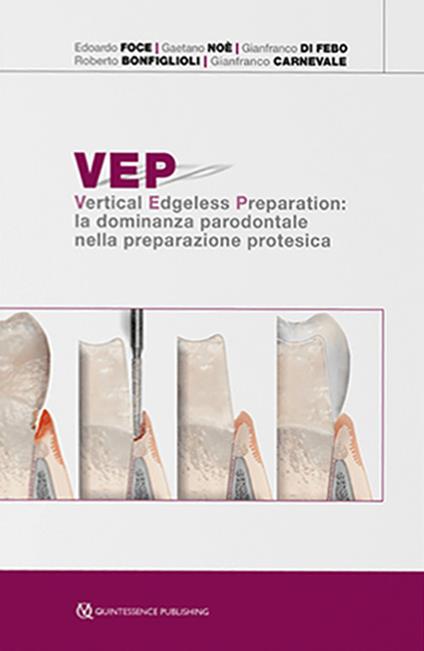 VEP. Vertical edgeless preparation: la dominanza parodontale nella preparazione protesica - Edoardo Foce,Gaetano Noè,Gianfranco Di Febo - copertina