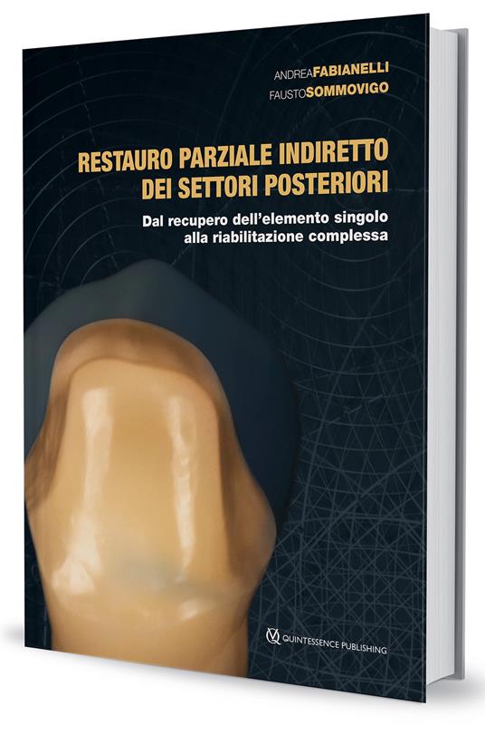 Restauro parziale indiretto dei settori posteriori. Dal recupero dell'elemento singolo alla riabilitazione complessa - Andrea Fabianelli,Fausto Sommovigo - copertina