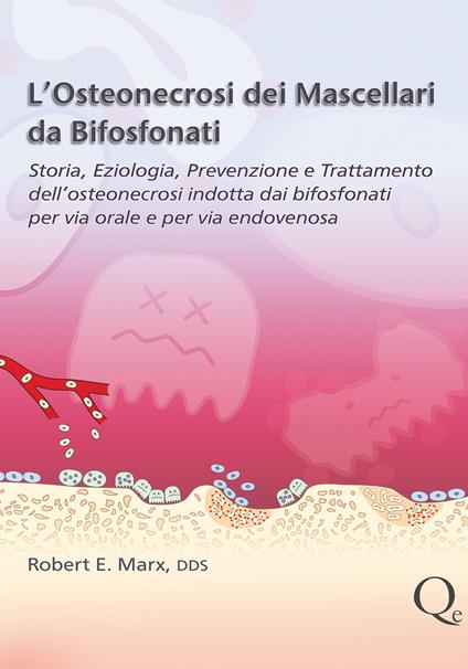 L'osteonecrosi dei mascellari da bifosfonati - Robert E. Marx - copertina