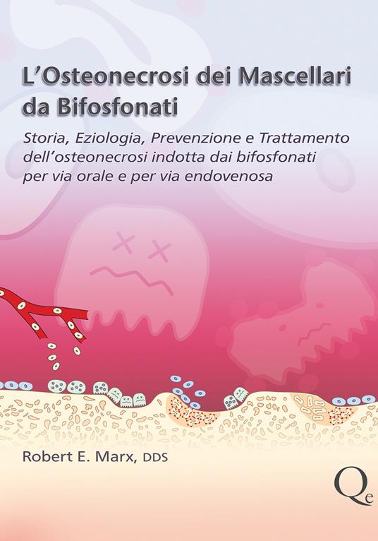 L'osteonecrosi dei mascellari da bifosfonati - Robert E. Marx - copertina