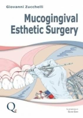 Mucogingival esthetic surgery. Nuova ediz. - Giovanni Zucchelli - copertina