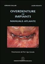 Overdenture su impianti. Manuale atlante