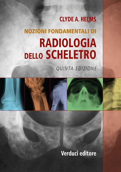 Radiologia dello scheletro. Nozioni fondamentali - Clyde A. Helms - copertina