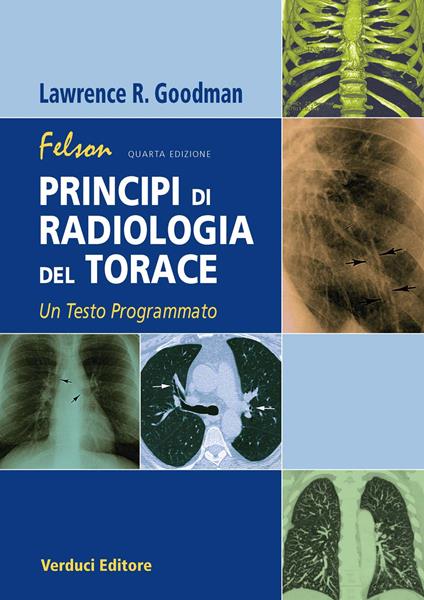Felson. Principi di radiologia del torace. Un testo programmato - Lawrence R. Goodman - copertina