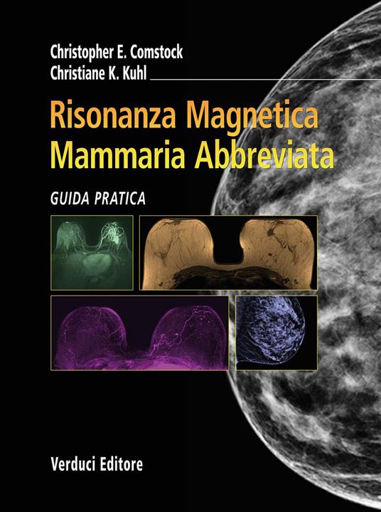 Risonanza magnetica mammaria abbreviata. Guida pratica - Christopher E. Comstock,Christiane K. Kuhl - copertina