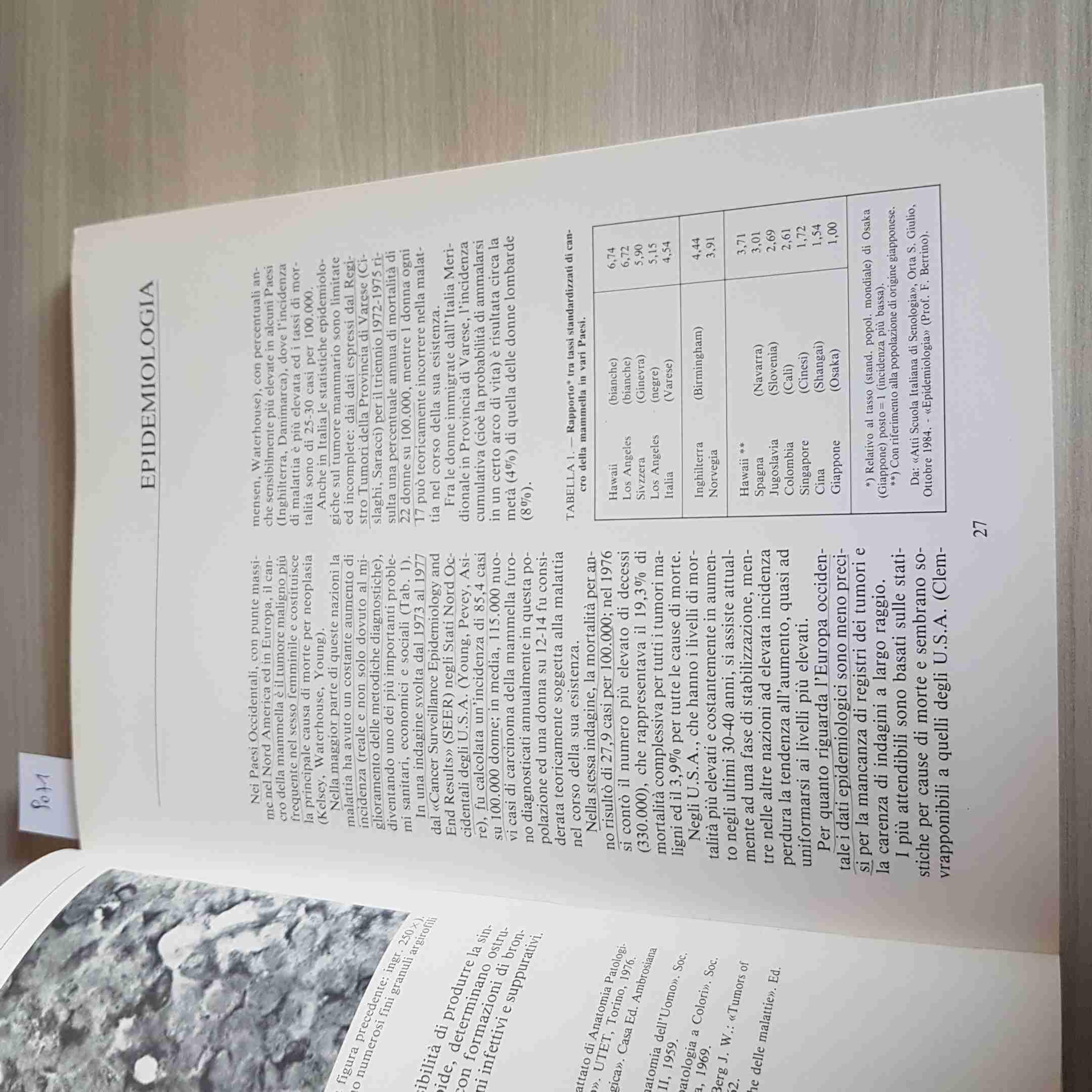 Il cancro della mammella