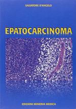 Epatocarcinoma