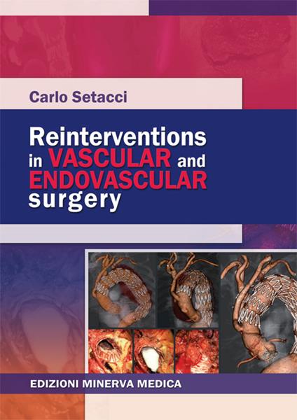 Reinterventions in vascular and endovascular surgery - Carlo Setacci - copertina