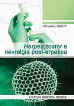 Herpes zoster e nevralgia post-erpetica