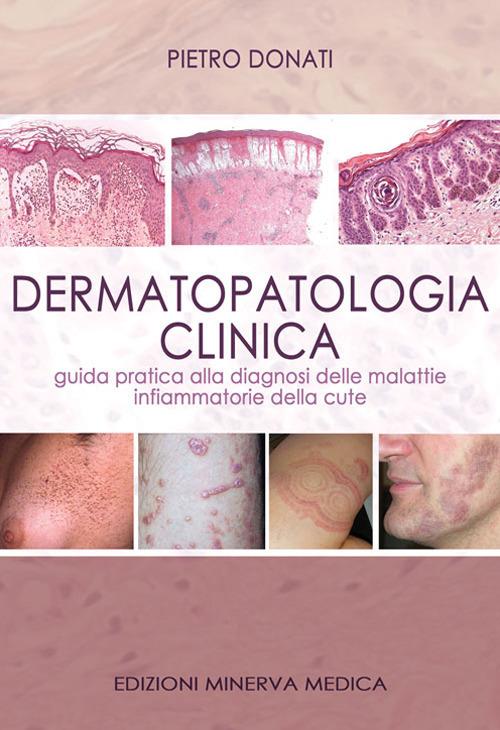 Dermatopatologia clinica. Guida pratica alla diagnosi delle malattie infiammatorie della cute - Pietro Donati - copertina