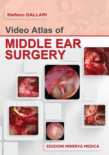 Video atlas of middle ear surgery - Stefano Dallari - copertina