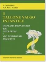 Il tallone valgo infantile. Displasia pronatoria della coxa pedis e vizi torsionali associati