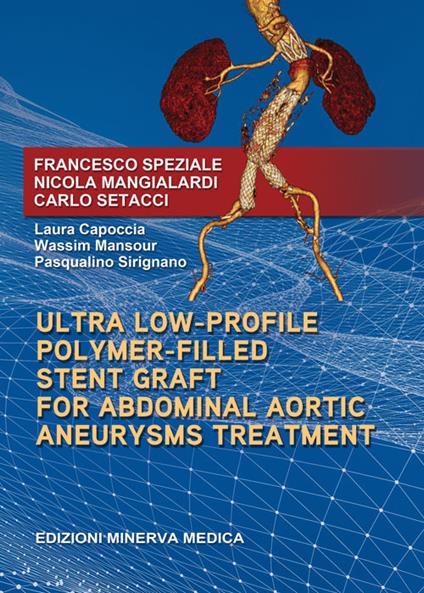 Ultra low-profile polymer-filled stent graft for abdominal aortic aneurysms - Francesco Speziale,Nicola Mangialardi,Carlo Setacci - copertina