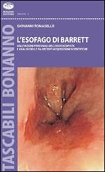 L' esofago di Barrett. Valutazioni personali dell'endoscopista e analisi sulle più recenti acquisizioni scientifiche