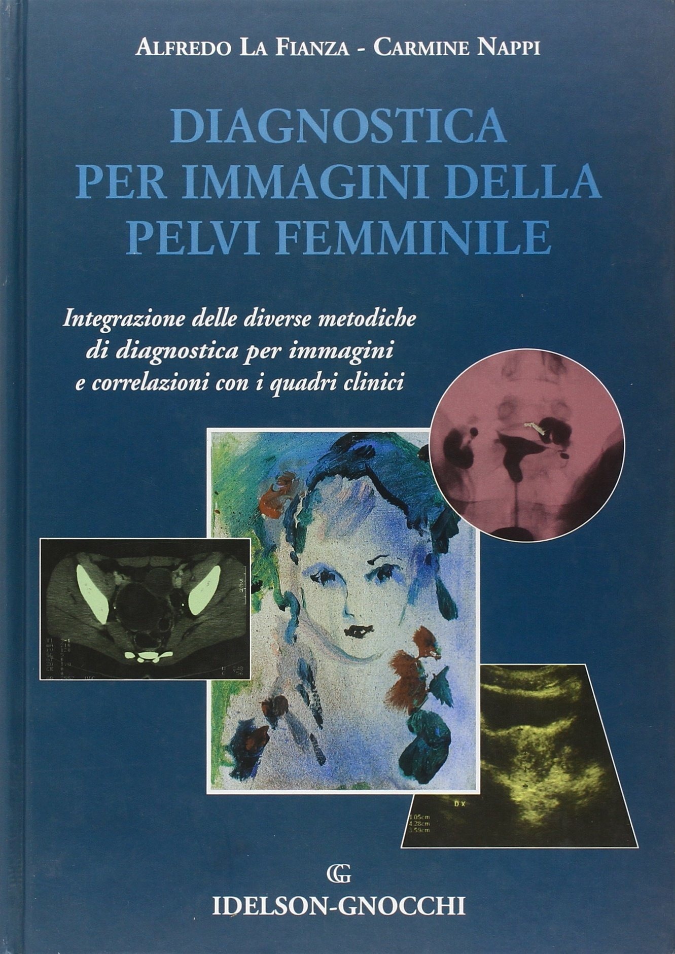 ibs