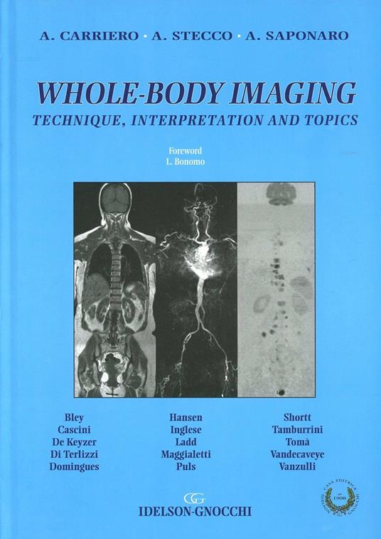Whole-body imaging. Technique, interpretation and topics - Alessandro Carriero,Alessandro Stecco,Antonio Saponaro - copertina