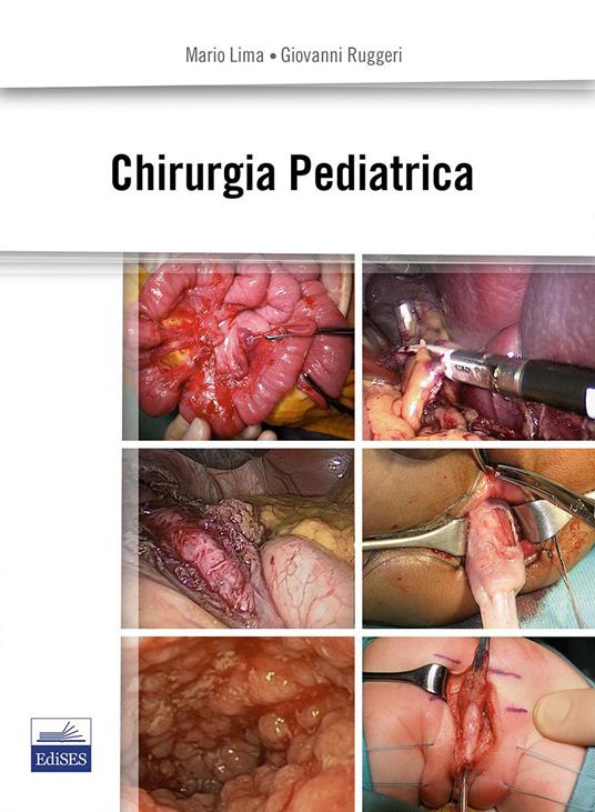 Chirurgia pediatrica - Mario Lima,Giovanni Ruggeri - copertina